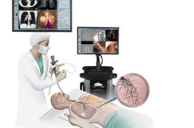 Bronchoscopy Procedure