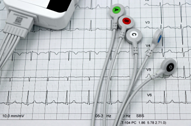 ECG Test