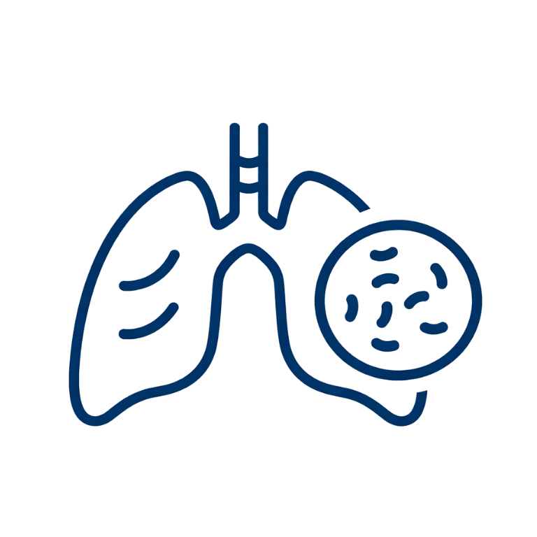 Tuberculosis treatment